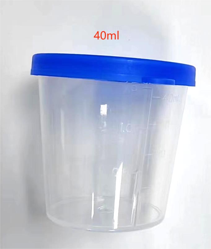 结核菌涂片检查